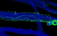 Fluorescent image of nerve growth on Spidrex silk. Learn more in the Prospector Knowledge Center.